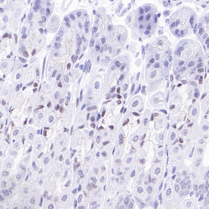 Caspase-8 Recombinant Rabbit mAb (S-2676-74)