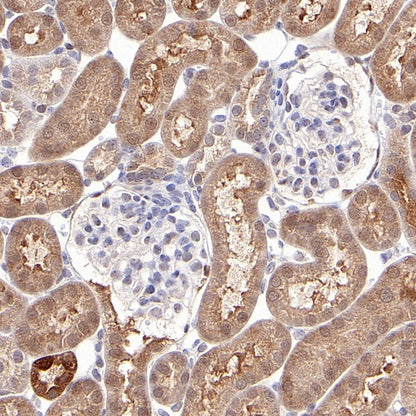 p90RSK Rabbit polyclonal antibody