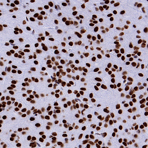 hnRNP H Rabbit Polyclonal Antibody
