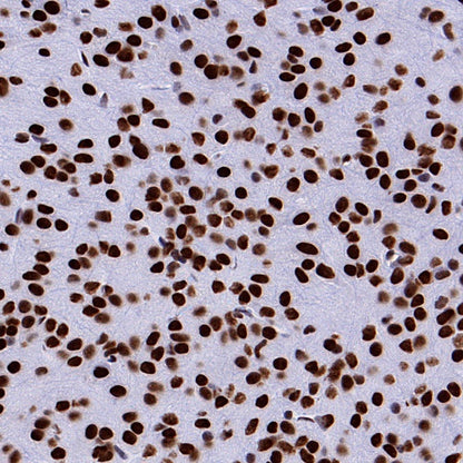 hnRNP H Rabbit Polyclonal Antibody