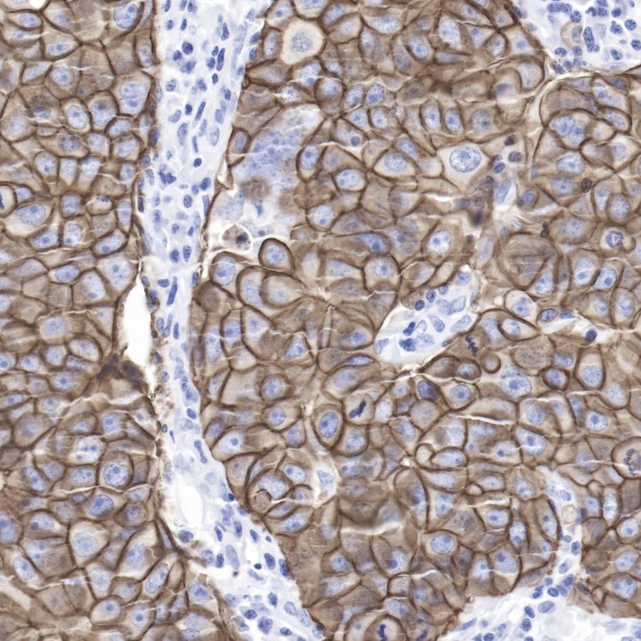 S-RMab® ErbB2 Recombinant Rabbit mAb,PBS Only (SDT-069-57)