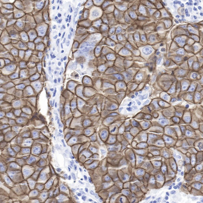 S-RMab® ErbB2 Recombinant Rabbit mAb,PBS Only (SDT-069-57)