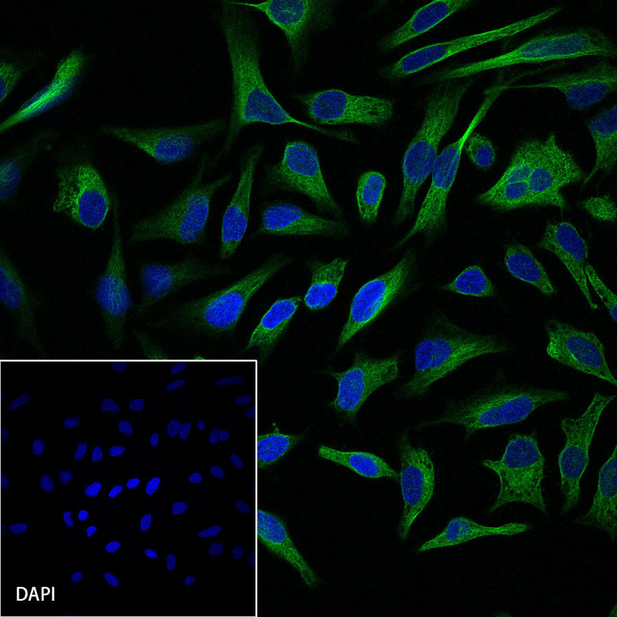 MEK1 Recombinant Rabbit mAb (SDT-308-32)