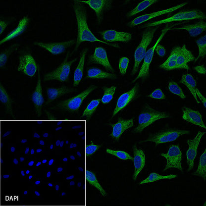 MEK1 Recombinant Rabbit mAb (SDT-308-32)