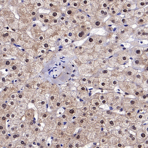AKT2 Recombinant Rabbit mAb (S-2617-6)