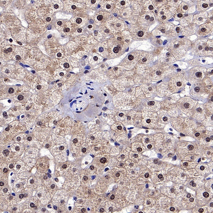 AKT2 Recombinant Rabbit mAb (S-2617-6)