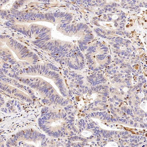 Talin-1 Recombinant Rabbit mAb (S-1483-25)