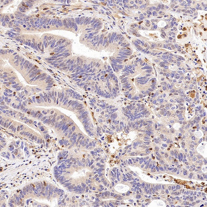 Talin-1 Recombinant Rabbit mAb (S-1483-25)