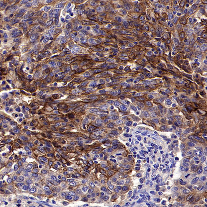 Desmocollin-2/3(DSC2/3) Recombinant Rabbit mAb (SDT-2102-59)