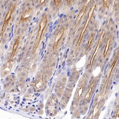 ZO-1 Recombinant Rabbit mAb (S-2188-12)