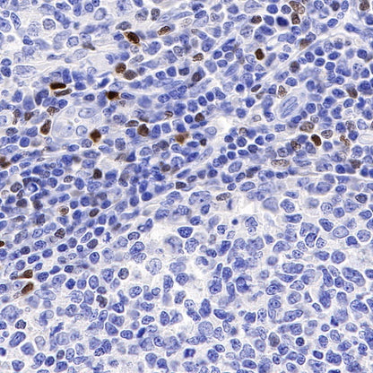 T-bet/TBX21 Recombinant Rabbit mAb (S-583-54)