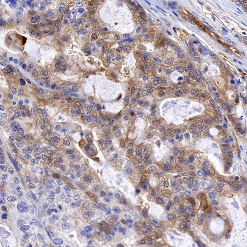 PTP1B Recombinant Rabbit mAb (S-R304)