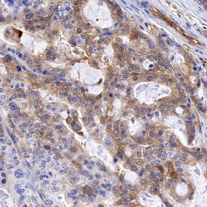 PTP1B Recombinant Rabbit mAb (S-R304)