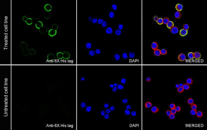 6x His tag (C-terminal) Recombinant Rabbit mAb (S-3882)