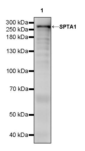 SPTA1 Recombinant Rabbit mAb (S-677-345)