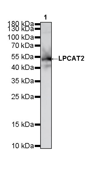 LPCAT2 Recombinant Rabbit mAb (S-4239-18)