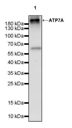 ATP7A Recombinant Rabbit mAb (S-2289-106)