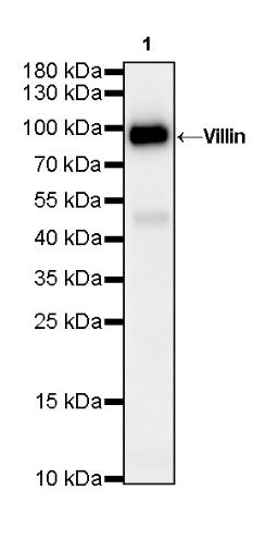 Villin Recombinant Rabbit mAb (SDT-R255)