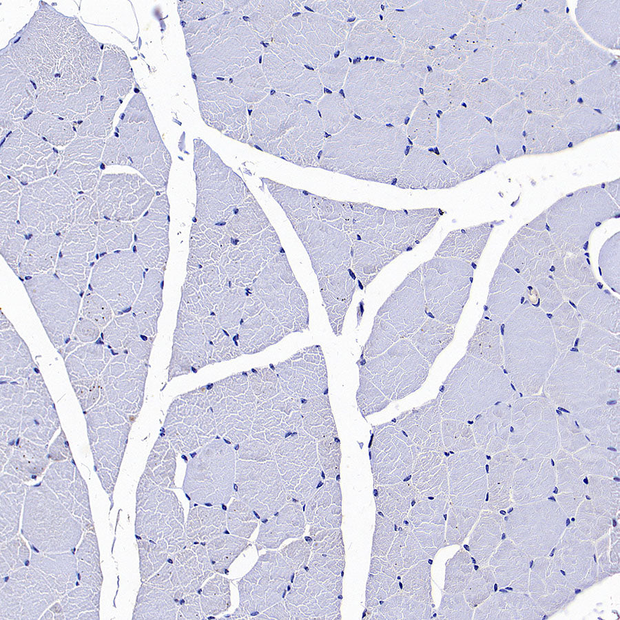 GPRC5A Recombinant Rabbit mAb (S-4383-15)