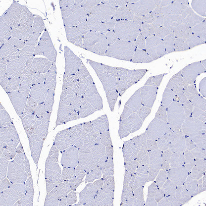 GPRC5A Recombinant Rabbit mAb (S-4383-15)