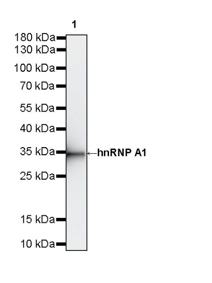 hnRNP A1 Recombinant Rabbit mAb