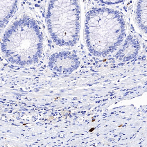 Granzyme B Recombinant Rabbit mAb (S-357-54)