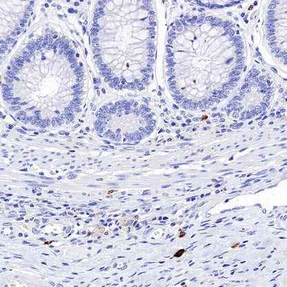 Granzyme B Recombinant Rabbit mAb (S-357-54)