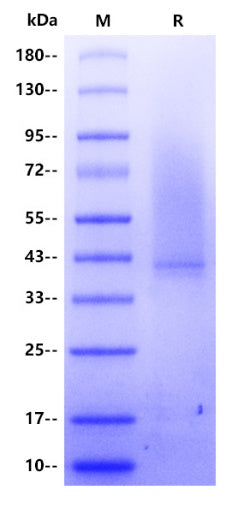 Human CD43 Protein, His Tag