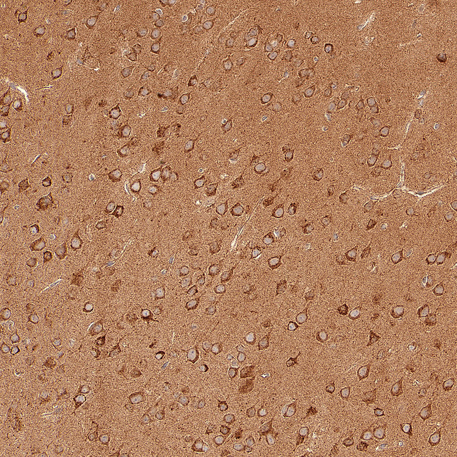 GOT2 Recombinant Rabbit mAb