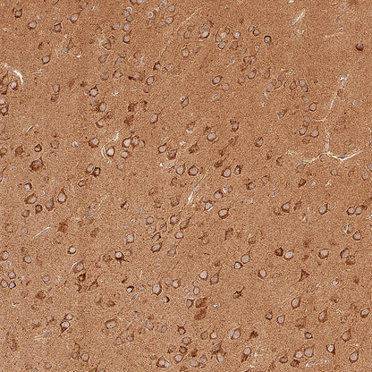 GOT2 Recombinant Rabbit mAb