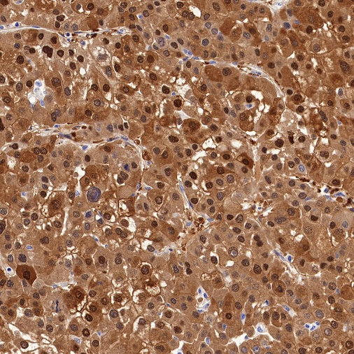 Arginase-1 Recombinant Rabbit mAb (SDT-369-33)