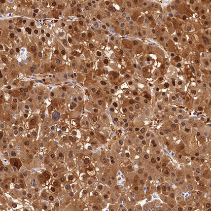 Arginase-1 Recombinant Rabbit mAb (SDT-369-33)