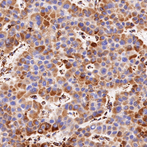 PBR/TSPO Recombinant Rabbit mAb (S-607-19)