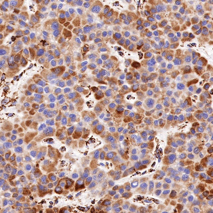 PBR/TSPO Recombinant Rabbit mAb (S-607-19)