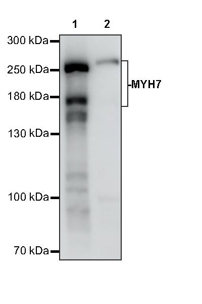 MYH7 Recombinant Rabbit mAb (S-4468-32)