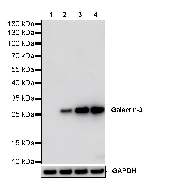 Galectin-3 Recombinant Rabbit mAb (SDT-370-111)