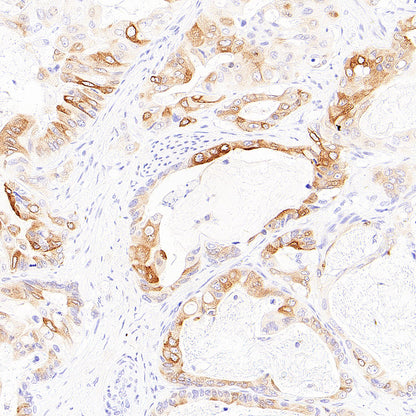 SCD Recombinant Rabbit mAb (S-4467-1)