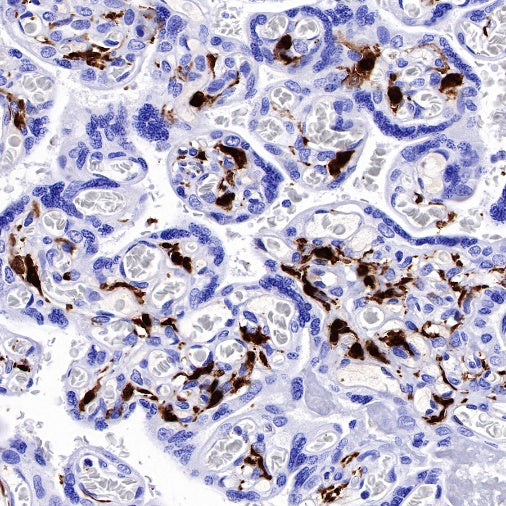Factor XIIIa Recombinant Rabbit mAb (SDT-644-7)