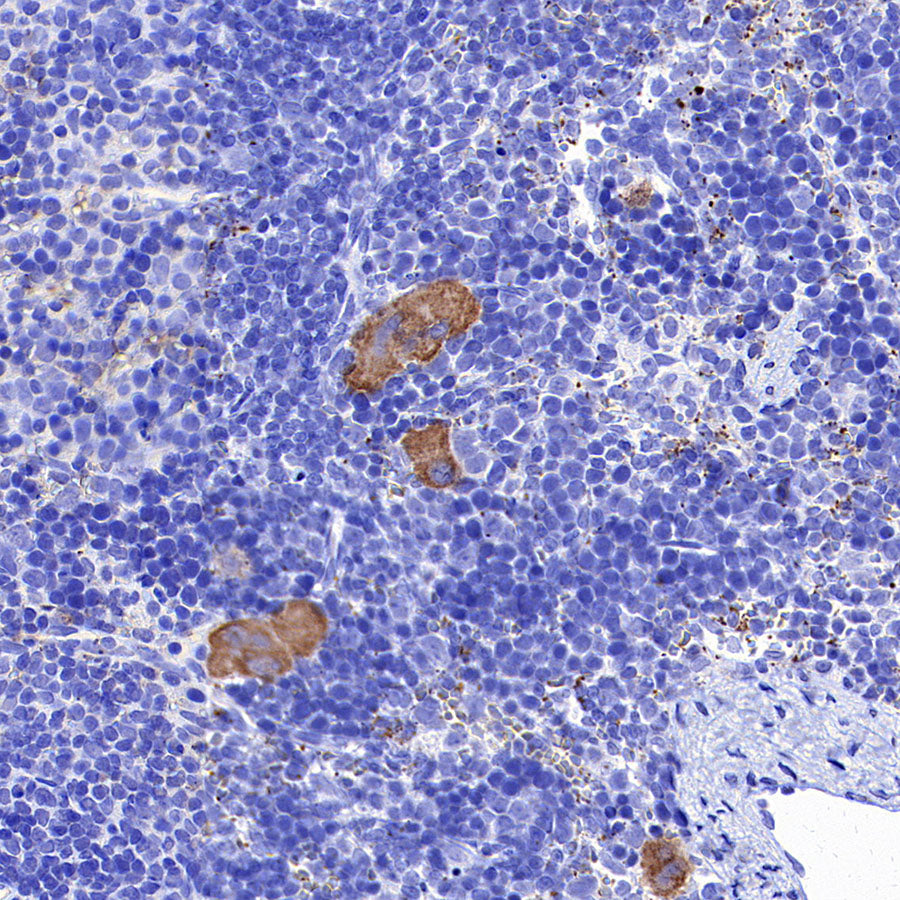 Thrombospondin 1 Recombinant Rabbit mAb (S-4153-22)