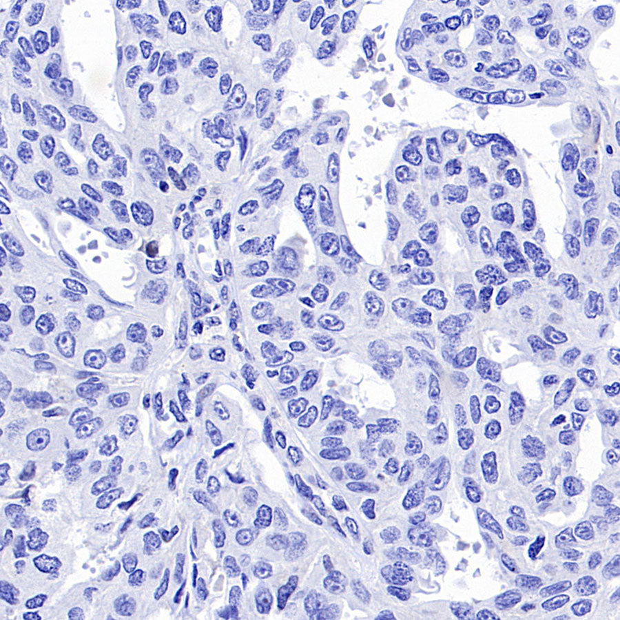 ARR3 Recombinant Rabbit mAb (S-3290-27)
