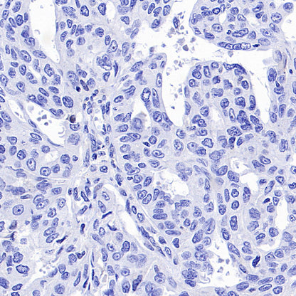 ARR3 Recombinant Rabbit mAb (S-3290-27)