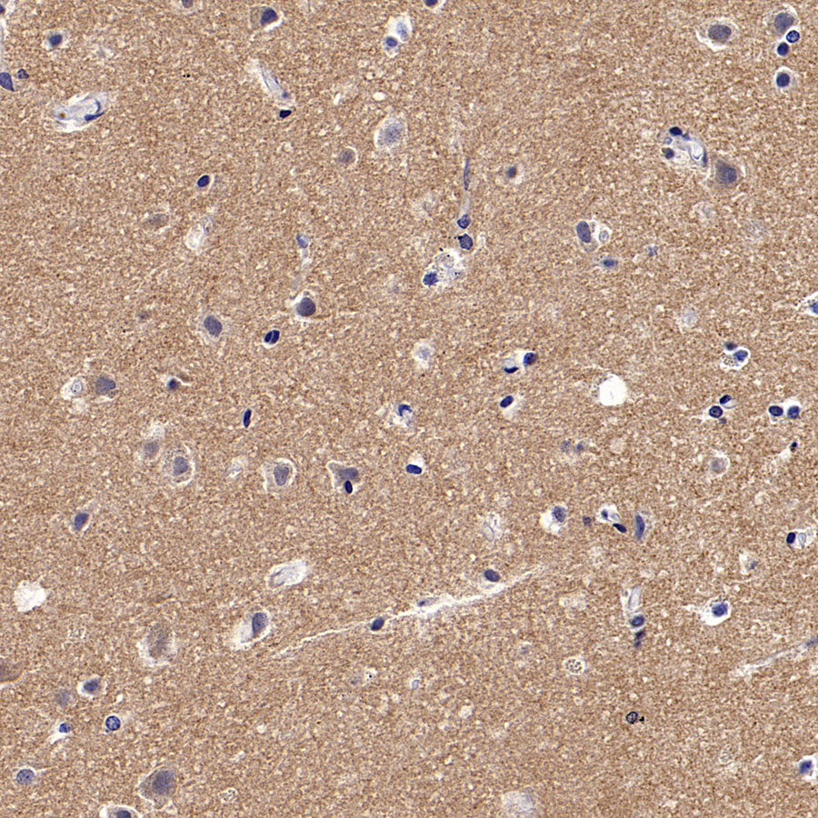 BCAR1 Recombinant Rabbit mAb (S-3542-49)