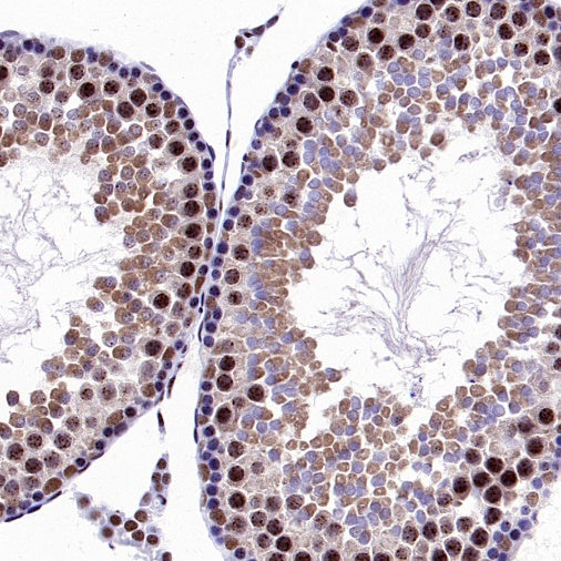 KDM4A Recombinant Rabbit mAb (S-957-138)