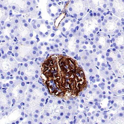 Claudin 5 Recombinant Rabbit mAb (SDT-R322)