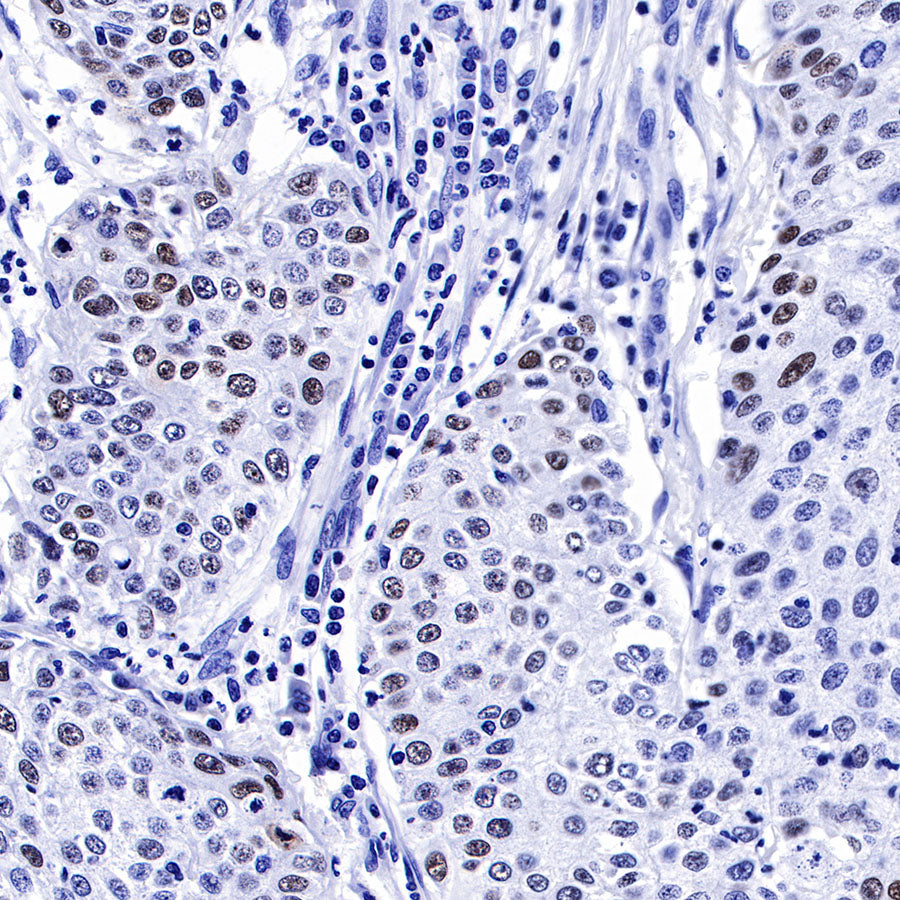 S-RMab® p53 Recombinant Rabbit mAb (SDT-R118)