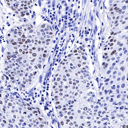 S-RMab® p53 Recombinant Rabbit mAb (SDT-R118)