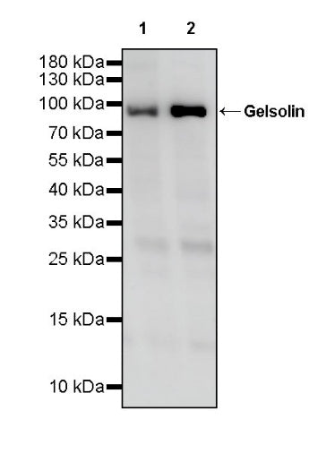 Gelsolin Recombinant Rabbit mAb (S-2522-21)