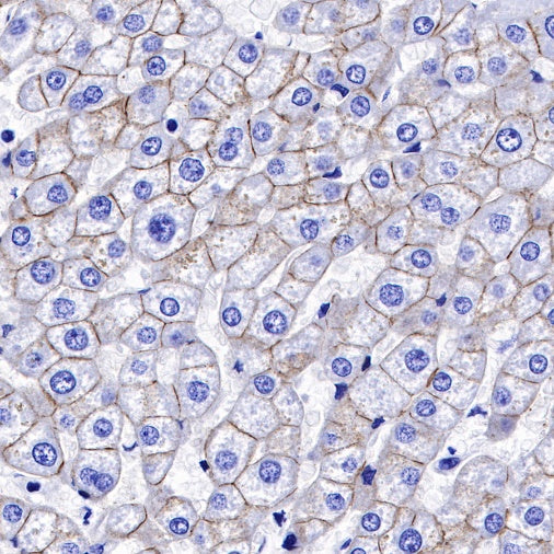 E-Cadherin Recombinant Rabbit mAb (SDT-438-45)