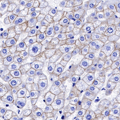 E-Cadherin Recombinant Rabbit mAb (SDT-438-45)