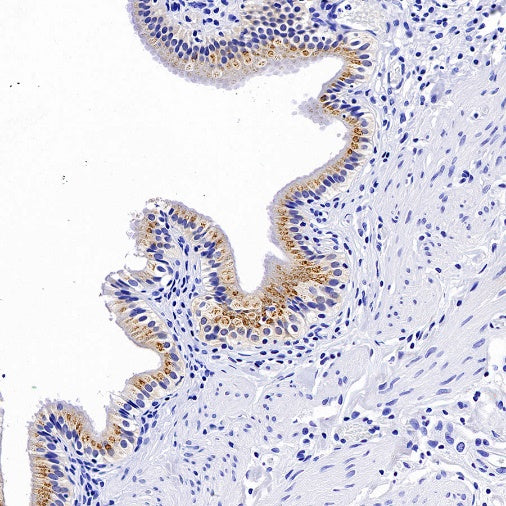 FGF-19 Recombinant Rabbit mAb (SDT-1070-17)
